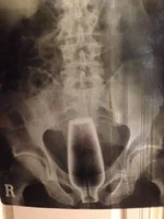 Xray.webp
