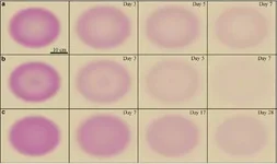 Dynamics-of-the-Lyme-Disease-rash-featured.webp