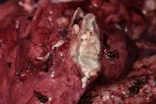 Lungs 2.webp