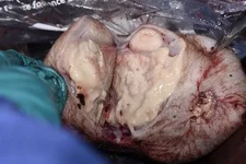 Testicles.webp