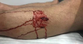 Boar protection.webp