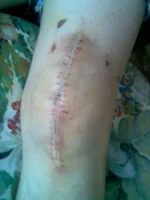 knee.webp