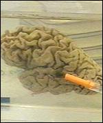 _967133_brain_spongi150.jpg